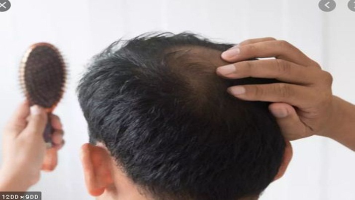 Hair loss? A few simple foods will prevent hair loss in 7 days