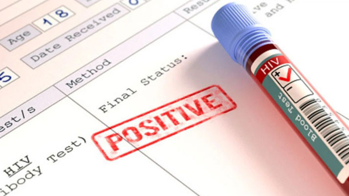 bardhaman-hiv-cases-rise-30-youth-infected-health-department-warning